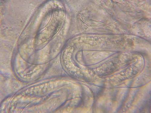 Mature eggs of the grass root-knot nematode, Meloidogyne graminis Whitehead. The second-stage juveniles (J2) can be seen coiled up inside indicating the egg is getting ready to hatch. Photograph by William T. Crow, University of Florida.