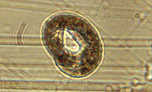 Reniform nematode, Rotylenchulus reniformis Linford & Oliveira, tightly coiled to undergo anhydrobiosis under drought conditions.